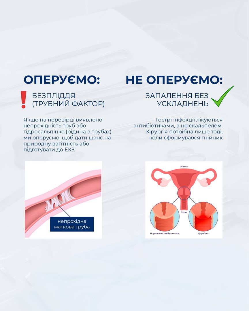 Безпліддя і запалення — коли оперувати